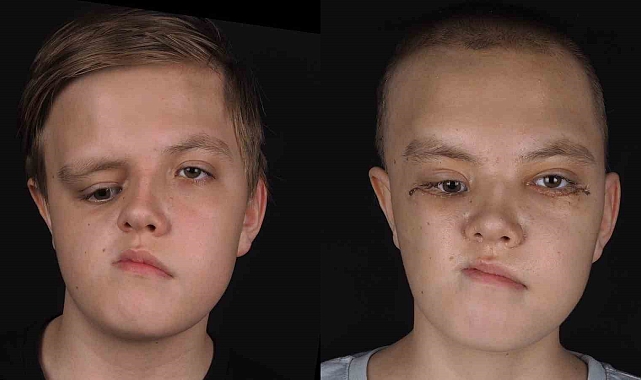 Kazakistanlı Nikita şifayı Pendik&#039;te buldu