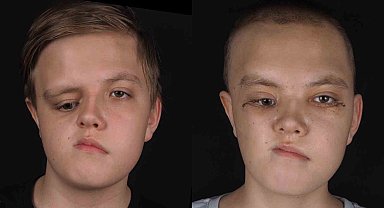 Kazakistanlı Nikita şifayı Pendik'te buldu