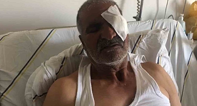 Iğdır’daki yayla saldırısında ağır yaralanan kişi saldırı anlarını anlattı