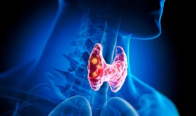Tiroit bozuklukları, farklı hastalıklara davetiye çıkarıyor