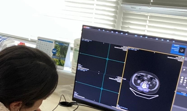 Akciğer kanseri yapay zeka ile erken teşhis etmek mümkün