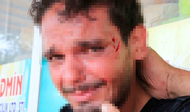 Alkollü Adam Yüzünden Yaralandı, Polis Ekiplerine Direndi