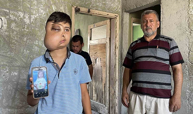 Enes&#039;in tek isteği  tedavi olursa ilk olarak aynaya bakarak gülümsemek