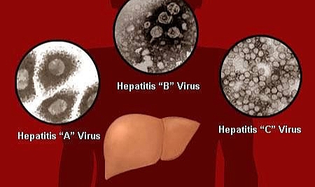 Hepatit B ve C&#039;nin tehlikelerine dikkat
