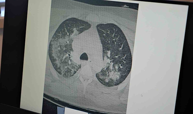 &quot;Kalp krizi vakalarının sebebi Kovid-19 olabilir&quot;