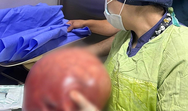 Karın ağrısı şikayeti ile geldi, rahminden 5,5 kilogramlık kitle çıktı