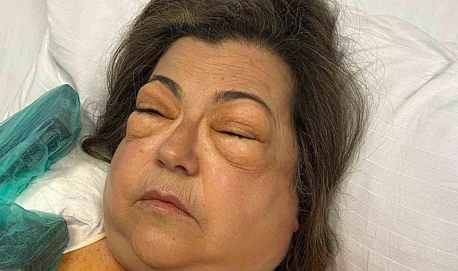 Midesi bulanan talihsiz kadının kusma esnasında soluk borusu yırtıldı