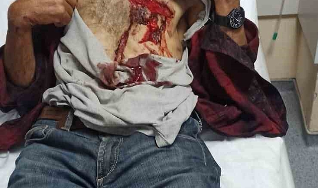 Domuz saldırınsa uğrayan adam o anları anlattı