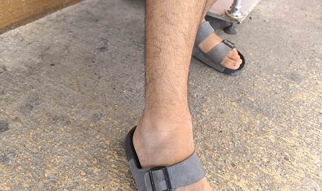 Duş alırken banyodaki akrebin bacağını ısırdığı genç, hastaneye kaldırıldı