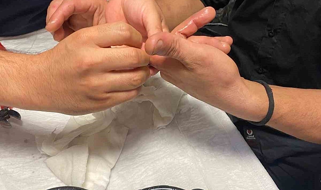 Bir vatandaşın parmağına sıkışan yüzük, kesilerek çıkarıldı