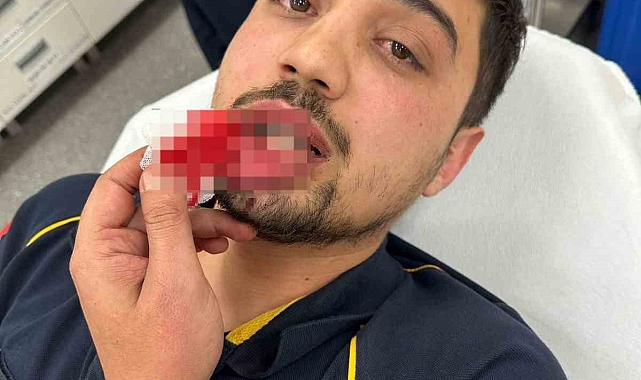 Ambulans şoförü darp edildi