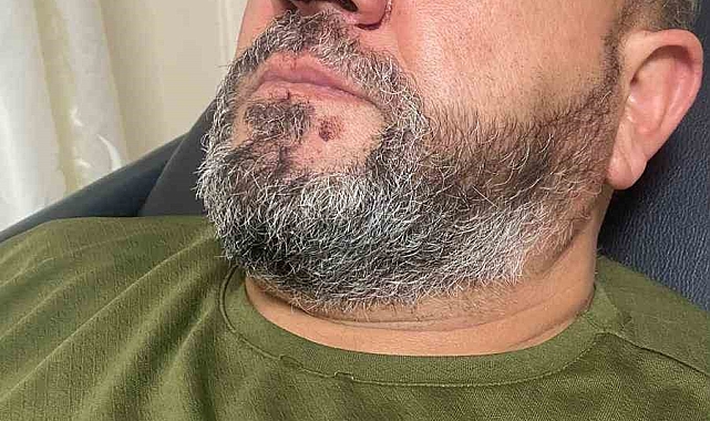 Cami imamını dövüp hastanelik ettiler