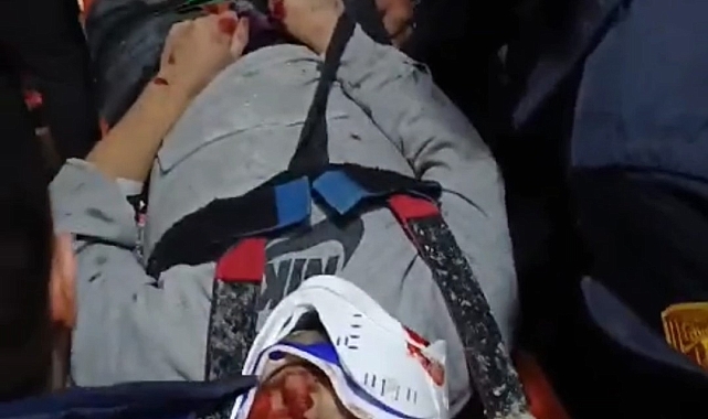 Asansör boşluğuna düşen şahıs yaralandı