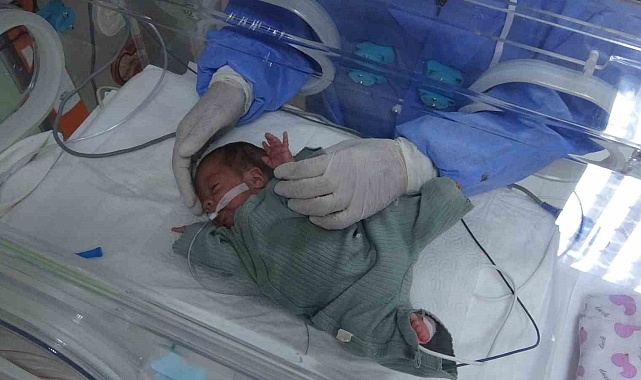 Prematüre bebeğin yaşam mücadelesi