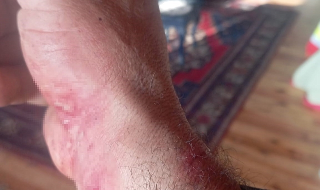 İspir&#039;de Kurt Saldırısı: Fahrettin Demir Köpekleri Sayesinde Hayata Tutundu