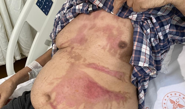 Lavabo açıcılarda patlama riski