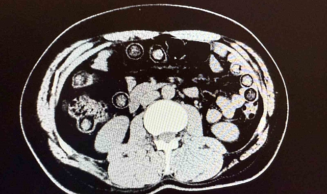 Midelerinde uyuşturucu taşıyan İranlı&#039;lar, tutuklandı