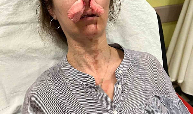 Edirne&#039;de Cinayet Sınırında Şiddet: Yanlış Kişiye Saldırı