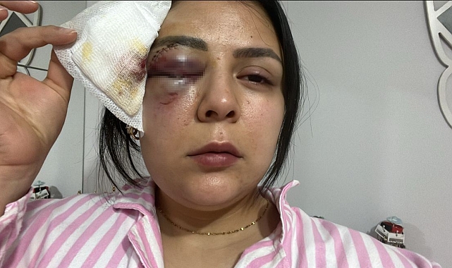 Genç Kızın Yaşadığı Korku Dolu Anlar