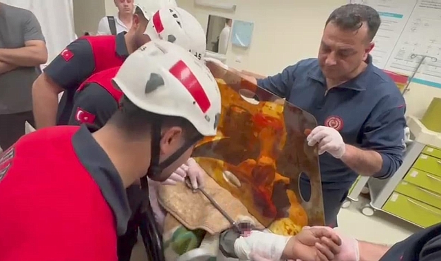 Şanlıurfa&#039;da Talihsiz Kaza: İşçinin Koluna Demir Şiş Saplandı