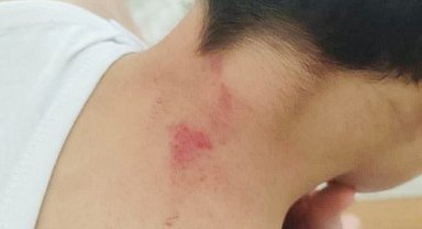 Şanlıurfa'da Öğrencisini Darp Eden Öğretmen Tutuklandı
