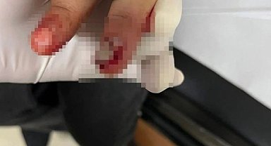 Kurtalan'da Korkutan Olay: 7 Yaşındaki Çocuğun Parmağı Spor Aletine Sıkıştı