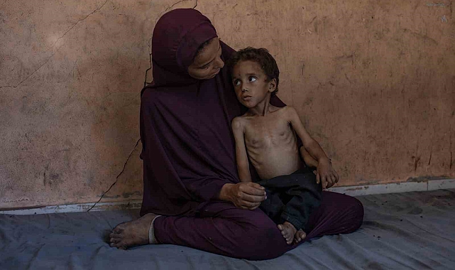 Gazze&#039;de Açlık ve Yetersiz Beslenme Can Kayıplarını Artırıyor: Ölü Sayısı 127&#039;ye Yükseldi