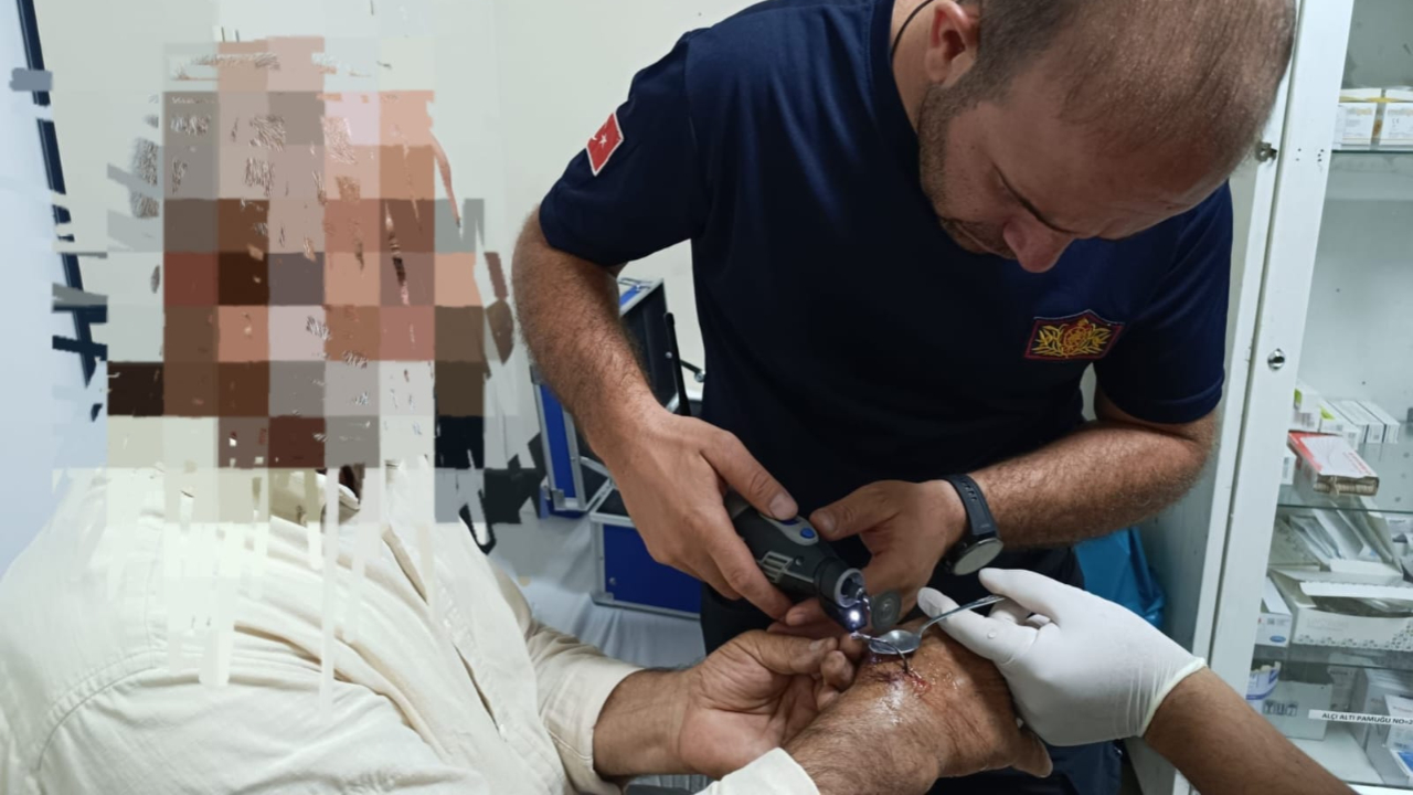 Iğdır’da Balık Macerası Hastanede Bitti: Kanca Eline Saplandı