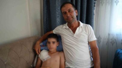 Samsun’da Köpek Dehşeti: 11 Yaşındaki Yunus’un Kolu Felç Kaldı