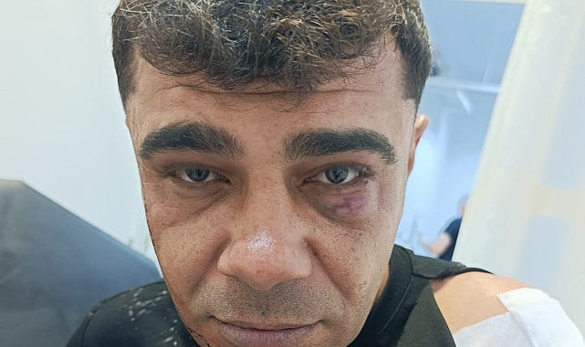 Malatya&#039;da İş Görüşmesi Dehşeti: Genç Saldırıya Uğradı