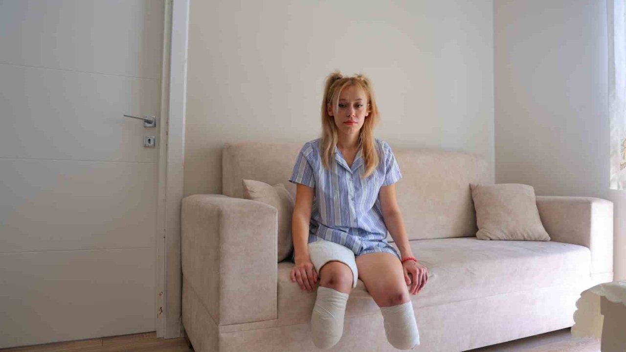 Düğün Gününde Motosiklet Kazası: Fitness Eğitmeni Genç Kadın İki Bacağını Kaybetti