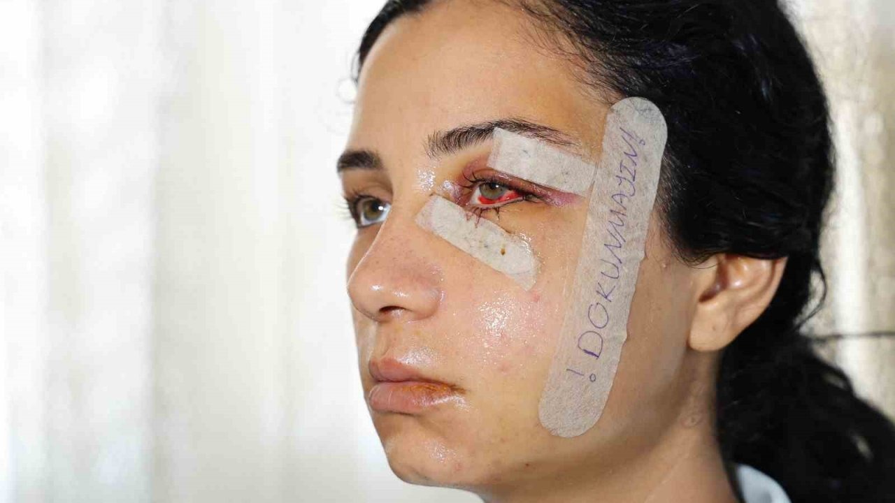 Eski Eşini Darp Eden Şahıs Tutuklandı: Kadının &quot;Yaşarken Kurtulayım&quot; Feryadı Karşılık Buldu