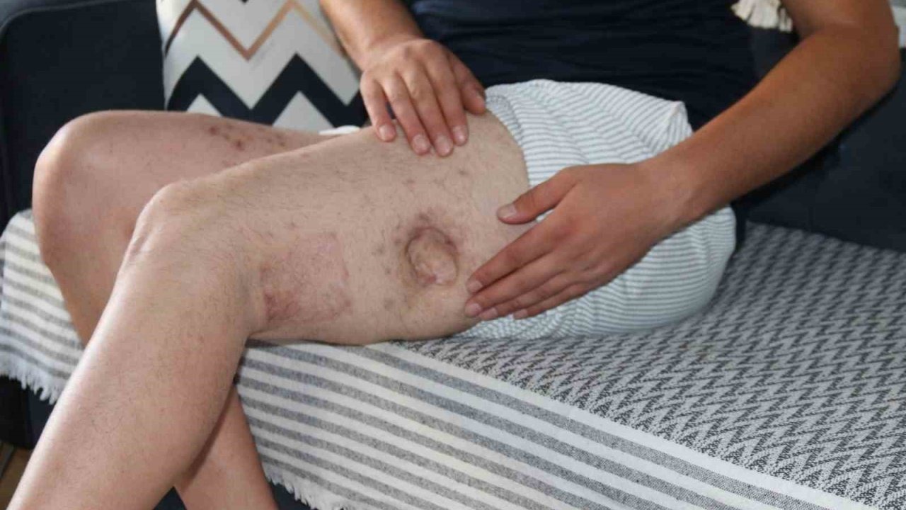 Eskişehir’deki Olayda Şok Gelişme: Yaralı Adam İfadesini Değiştirdi, Akrabası İcra Davası Açtı