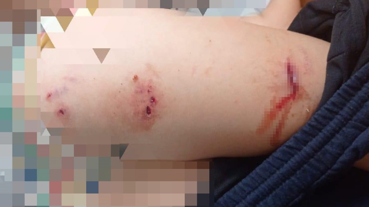 Sokak köpekleri faciaya neden oluyordu: Komşular yetişmeseydi parçalayacaklardı