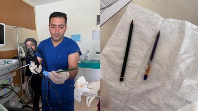 Ağrı’da Genç Kadının Midesinden İki Kalem Çıkarıldı