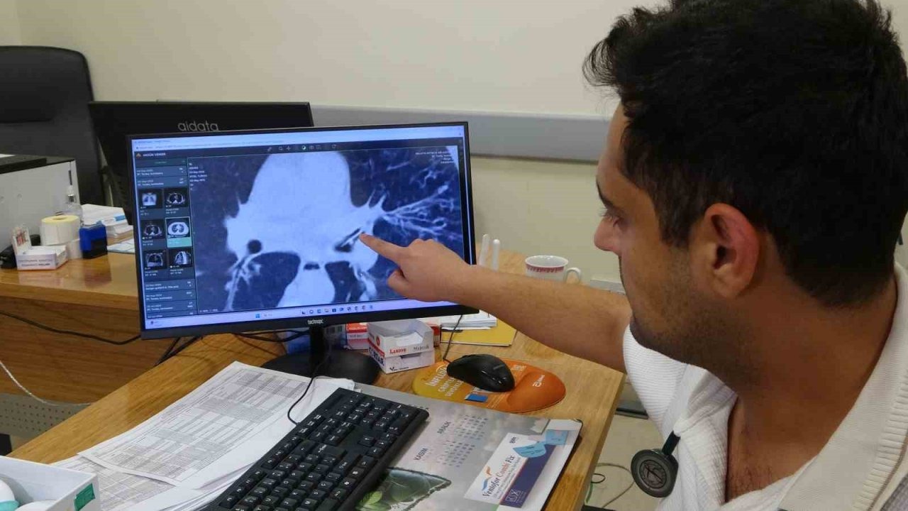 Kansersin, astımsın dediler: Akciğerinden kabak çekirdeği çıktı