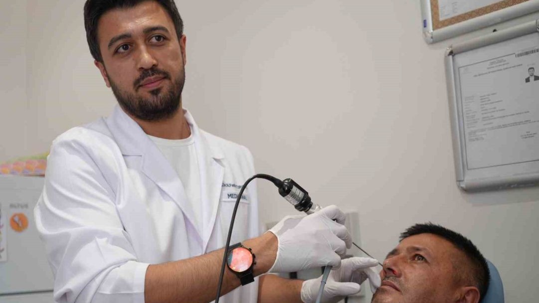 Eşi ve Arkadaşlarından Kaçan Adam, Burnundan Çıkarılan Protez Parçasıyla Kötü Kokudan Kurtuldu