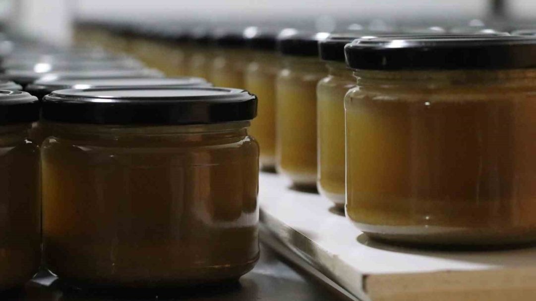 Kemik Erimesini İlikli Kemik Suyuyla Yendi: Dilek Öztürk Şifa Arayanlara Umut Oldu