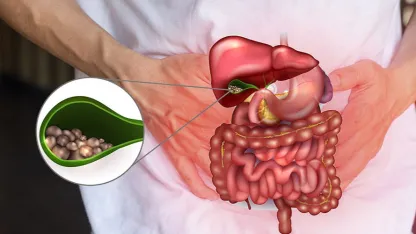 Kış Aylarında Ağır Beslenme Safra Kesesi Problemlerini Artırıyor