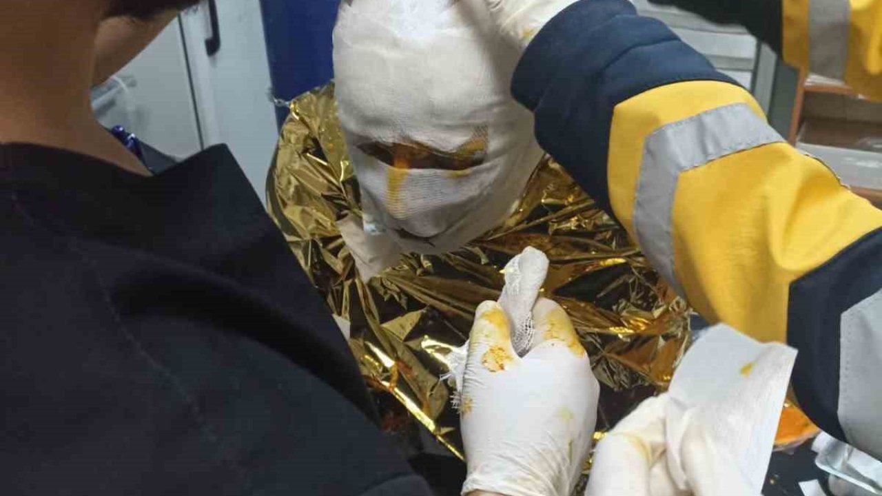 Erzincan’da Kömür Ocağında Metan Gazı Yangını: 2 İşçi Yaralandı