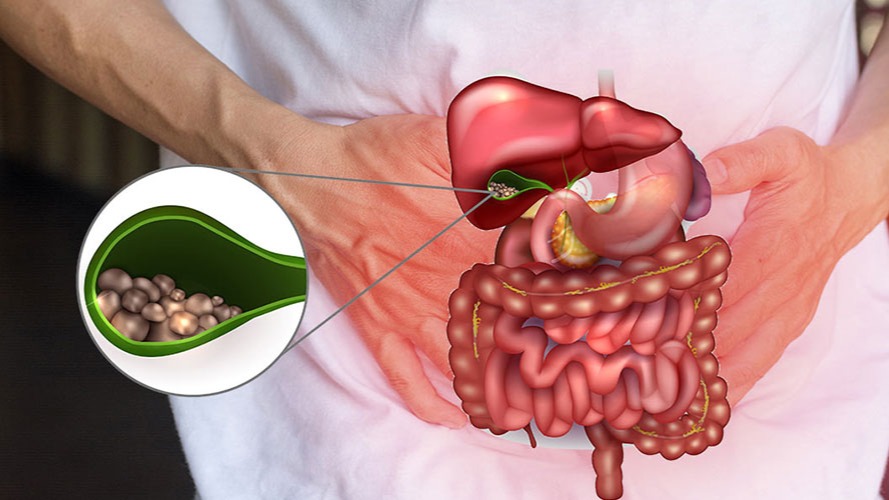 Kış Aylarında Ağır Beslenme Safra Kesesi Problemlerini Artırıyor