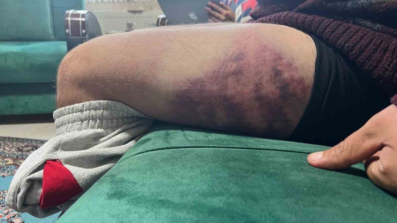 Kocaeli&#039;de Otizmli Gence Odunlu Saldırı İddiası: Ağır Yaralandı