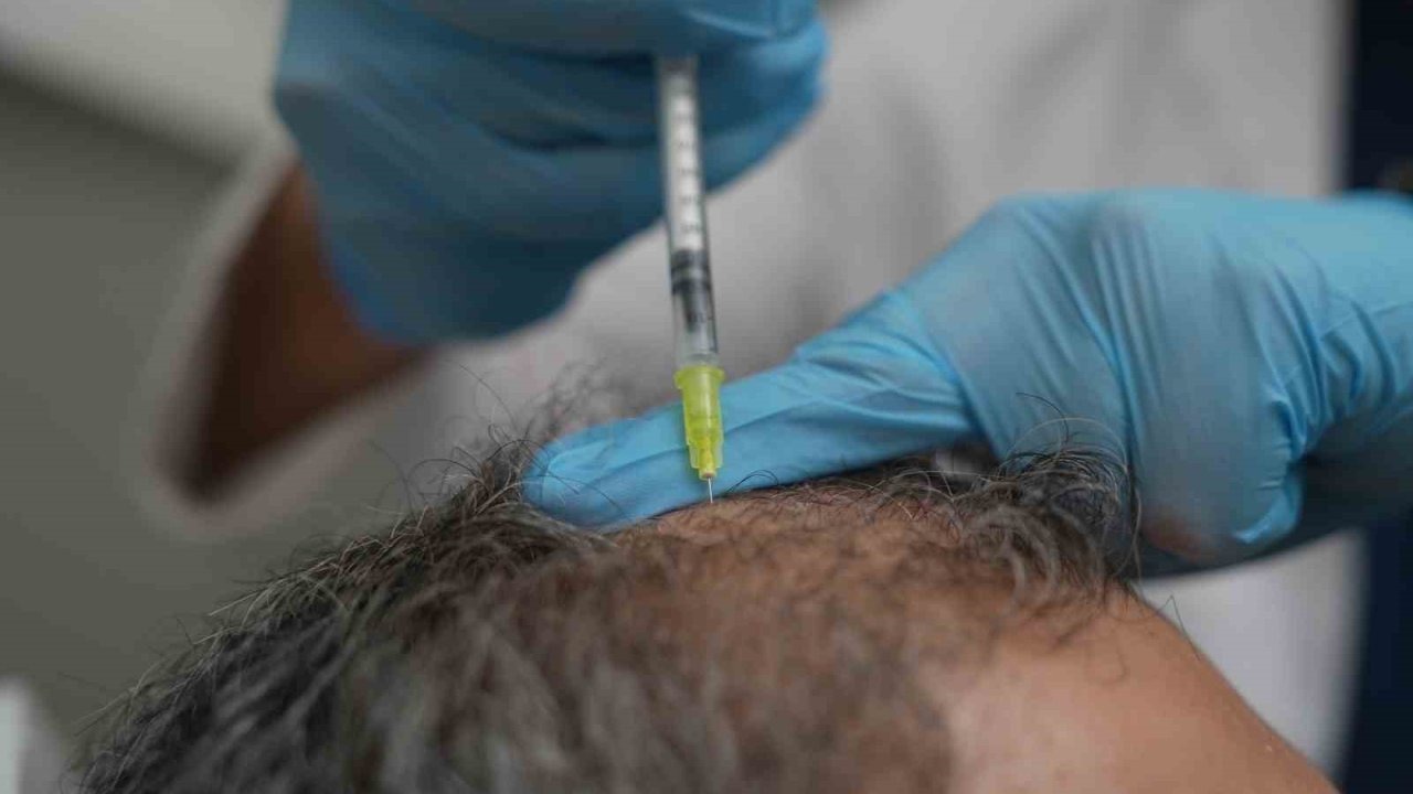 Saç Dökülmesi Bir Sağlık Sinyali Olabilir: Günde 100 Tel Üzerindeki Kayba Dikkat!