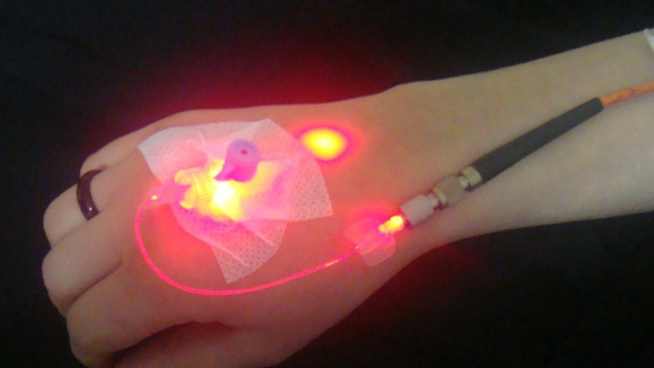 Tek Ayak veya Eldeki Şişlikler Lenfödem Habercisi Olabilir