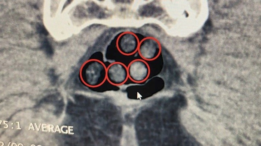 Bitlis’teki uyuşturucu operasyonunda 3 kişi tutuklandı