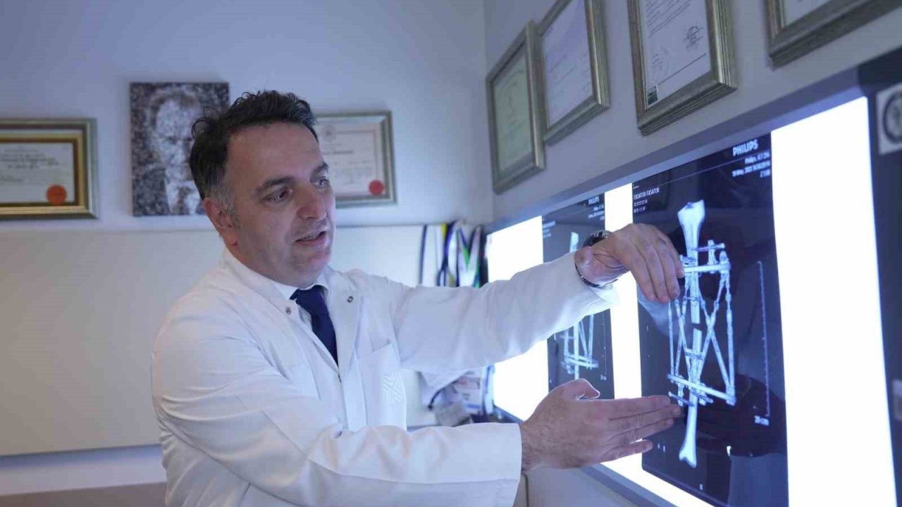 Kemik Uzatmada Yeni Dönem: Güvenli ve Konforlu Tedavi Seçenekleri