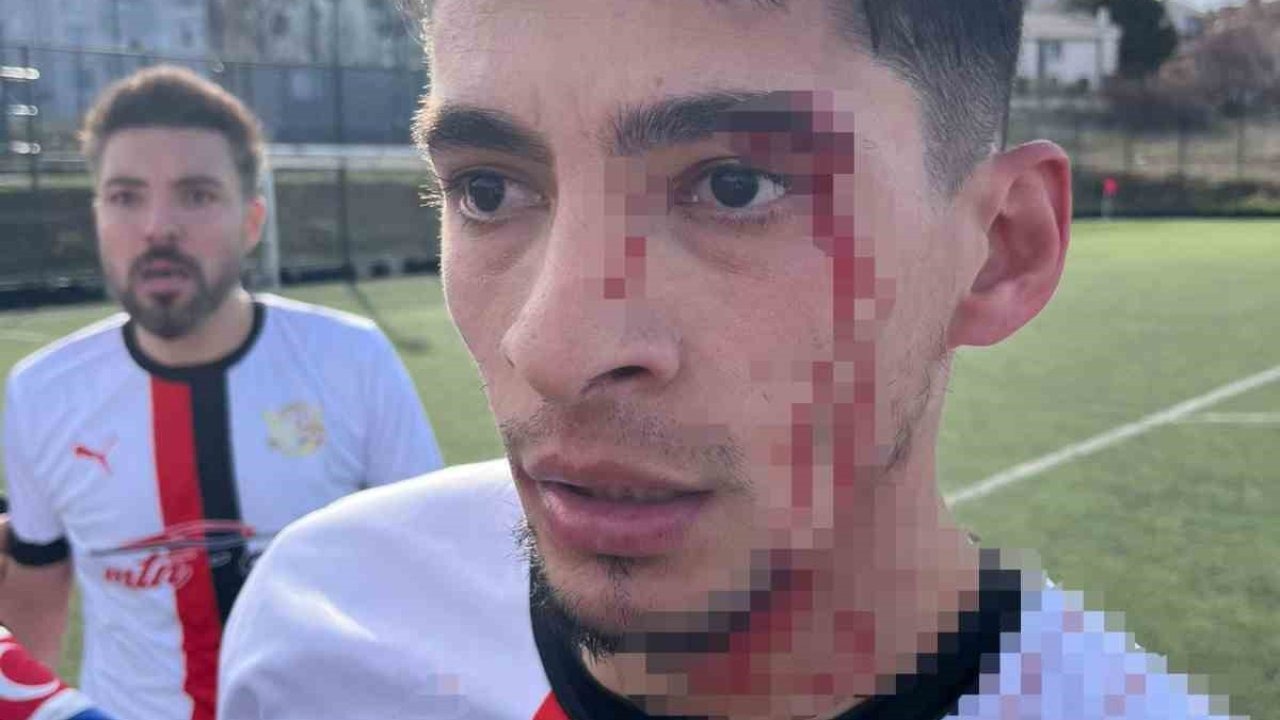 Maç sonrası saha içi savaş alanına döndü, 3 futbolcu hastanelik oldu