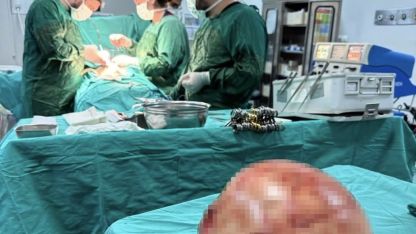 Van YYÜ’de Başarılı Operasyon: 35 Yaşındaki Kadının Karnından Dev Kitle Çıkarıldı