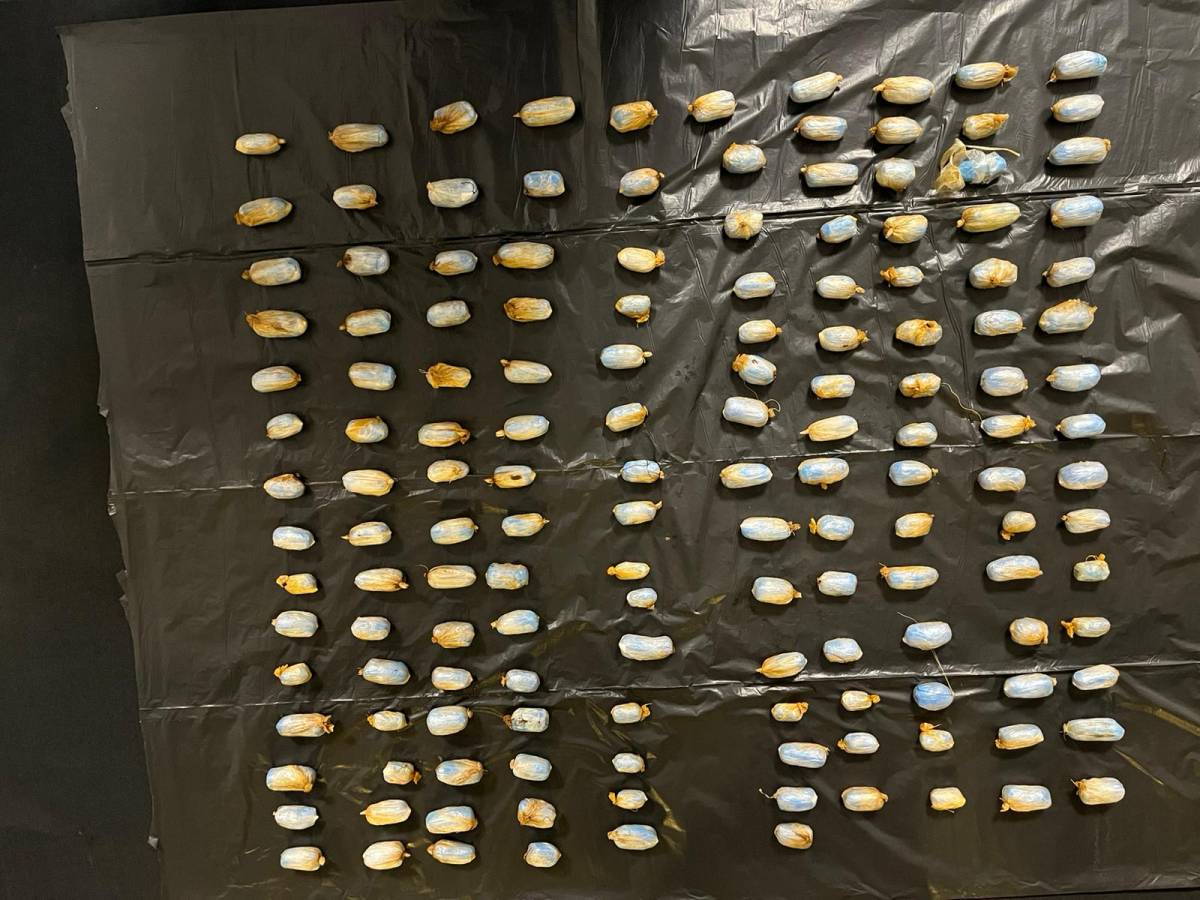 Iğdır Emniyeti'nden Film Gibi Operasyon: Vücudundan Yaklaşık 1 Kilo Uyuşturucu Çıktı!